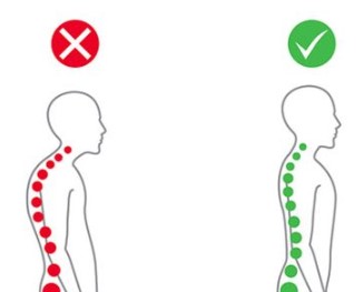 Posture correctors
