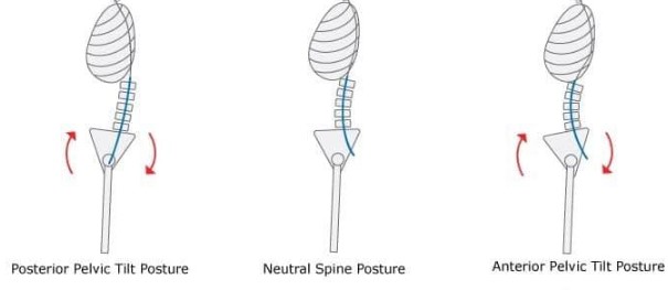 pelvic tilt posture