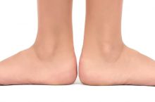 How to Correct Duck Feet Posture in Adults