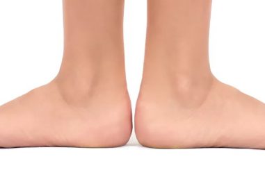 How to Correct Duck Feet Posture in Adults