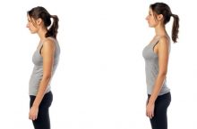 How to fix rounded shoulders and how long it takes