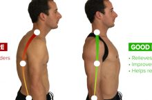 What Causes Rounded Shoulders?