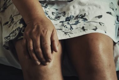 How to KT Tape Knee for Torn Meniscus